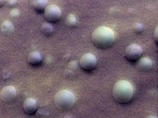 This mosaic image shows an extreme close-up of round, blueberry-shaped formations in the martian soil near a part of the rock outcrop at Meridiani Planum called Stone Mountain