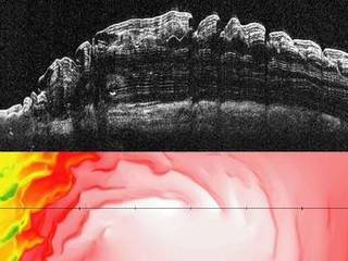What Lies Below a Martian Ice Cap